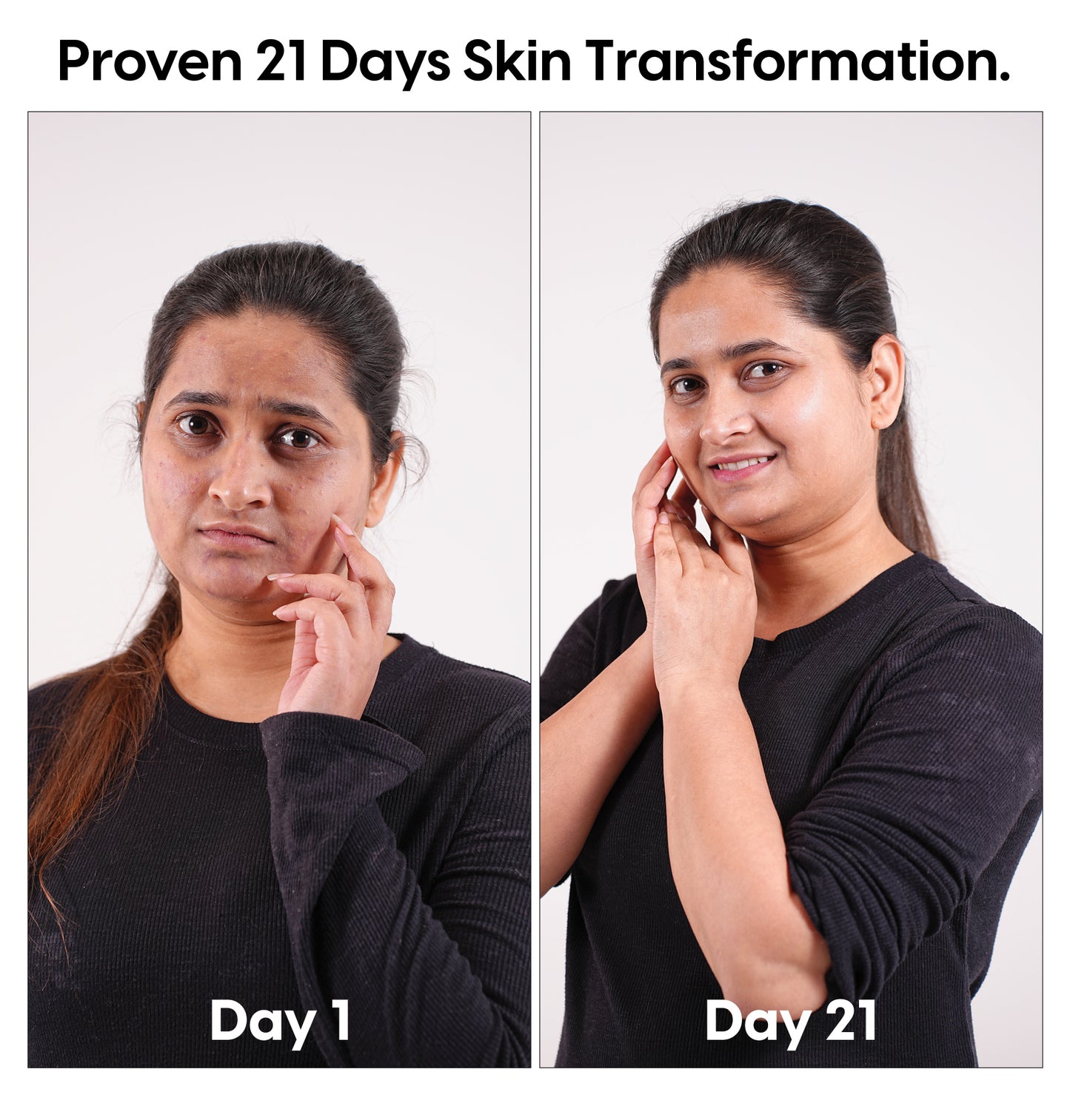 Dark Spots Corrector